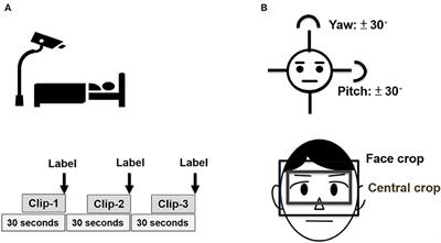 Deep Learning-Based Pain Classifier Based on the Facial Expression in Critically Ill Patients